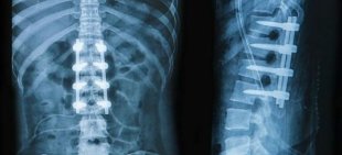 x-ray back