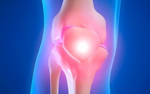 causes of osteoarthritis of the knee joint