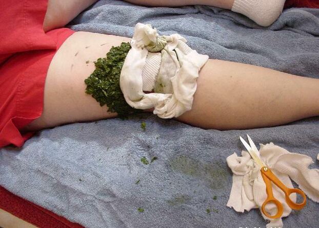Hot compress of crushed cabbage leaves on painful knee joint with arthrosis